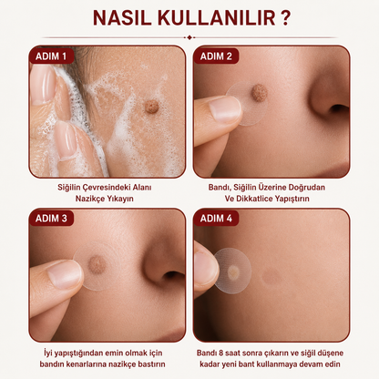 DERMAVA Mikro İğneli Ben Bandı 5 Günde Acısız Benlerinden Kurtul