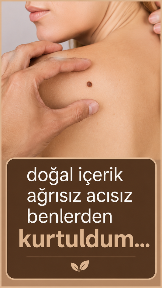 DERMAVA Mikro İğneli Ben Bandı 5 Günde Acısız Benlerinden Kurtul